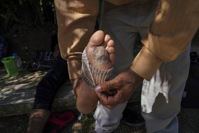 Salvadoran migrant, former member of the MS-13, shows the blistered foot of another migrant minutes after he applied cream to it near Palenque, Chiapas on Oct. 20. He says that the creams that they are given at the shelters in México do not work as well as the one that he brought from his country, so he shares it with others.